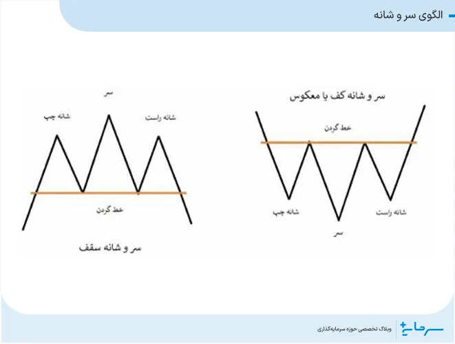 الگوی سر و شانه
